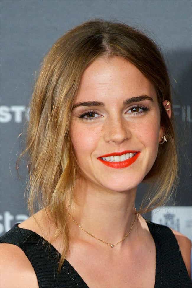 Celebrity denture wearers